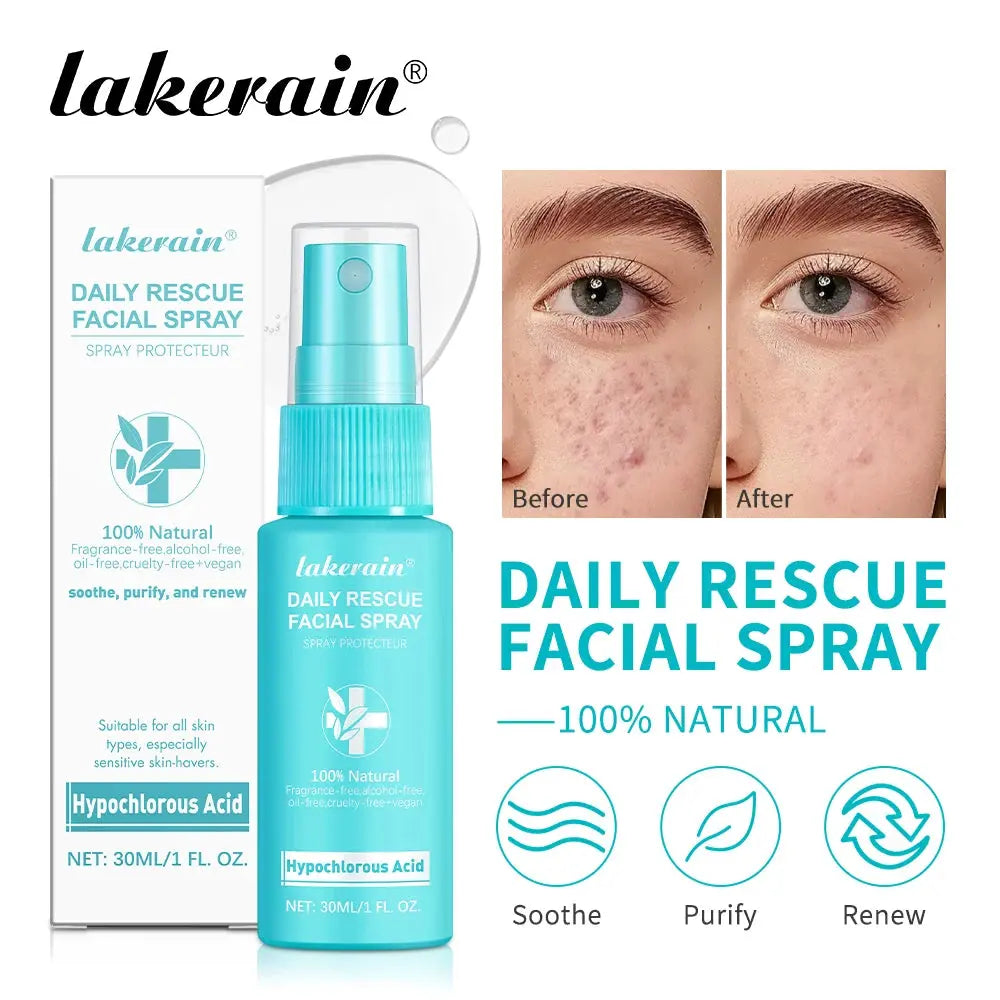 Calming Rescue Facial Mist Spray Nivora Lux