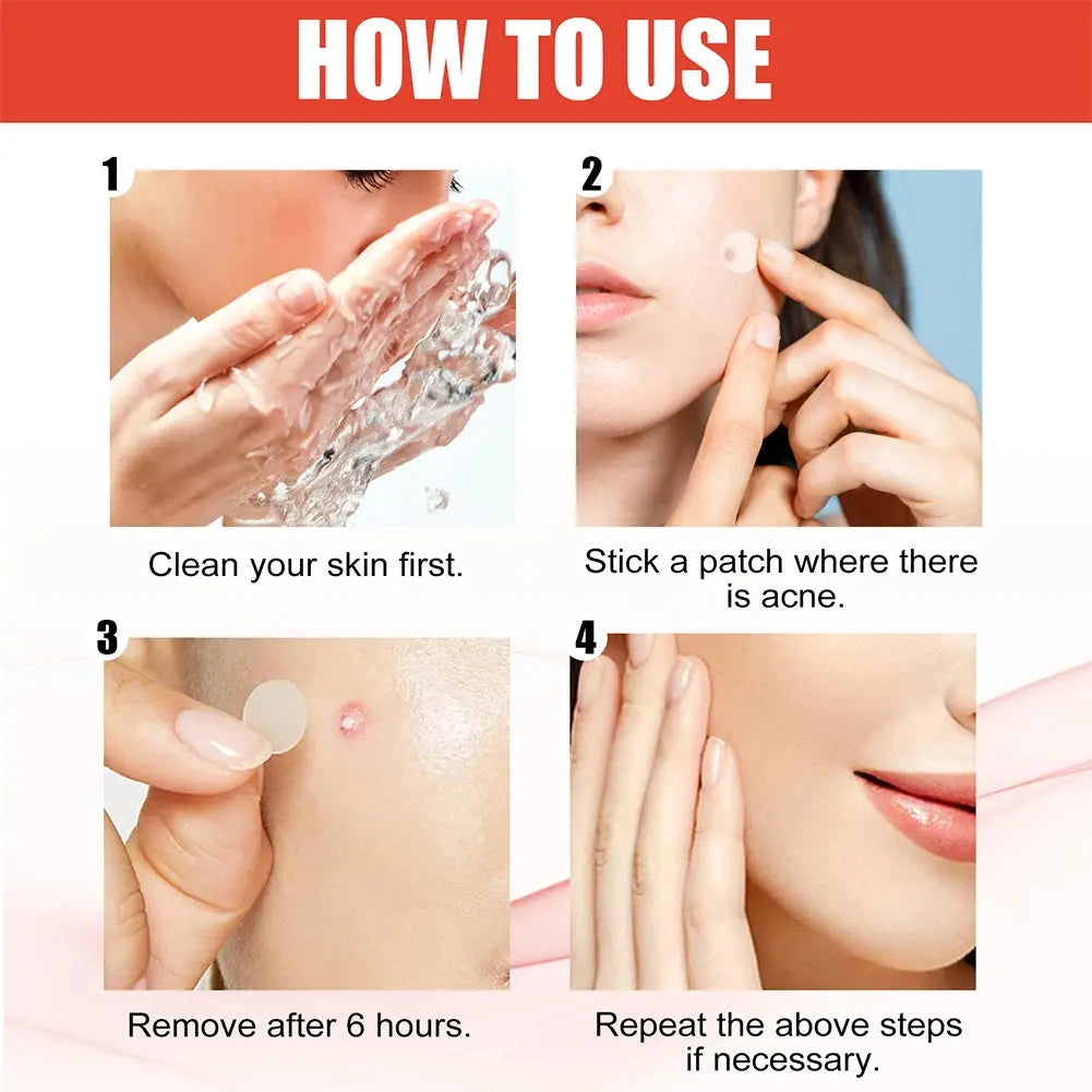 Invisible Acne Healing Patches Nivora Lux
