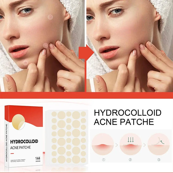 Invisible Acne Healing Patches Nivora Lux